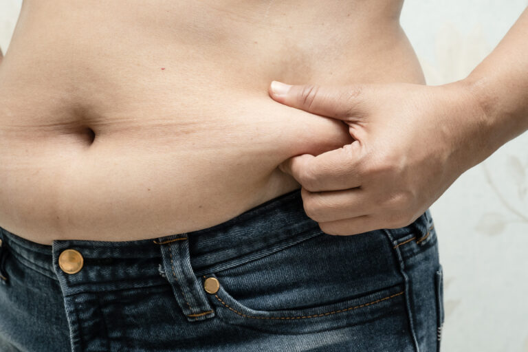 What Does PCOS Belly Look Like? PCOS Tummy Shape - My PCOS Kitchen